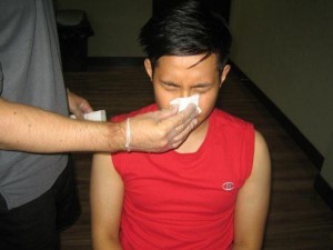 nasal-trauma